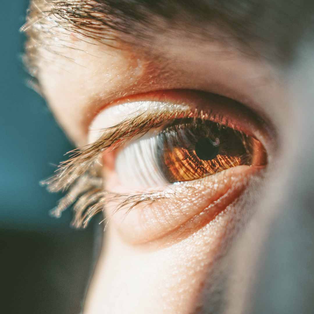 EyeCloseup_1080x1080 eye doctor providing keratoconus treatment | Union, NJ